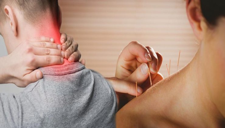 Fibromiyalji hastalarına mucize tedavi! Kuru iğne tedavisi ağrı noktaları…