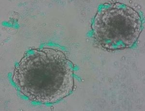 Kanser hücrelerini tespit etmek için bakteriler geliştirildi