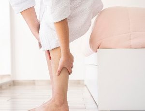 Yazın varis tedavisi olur mu?